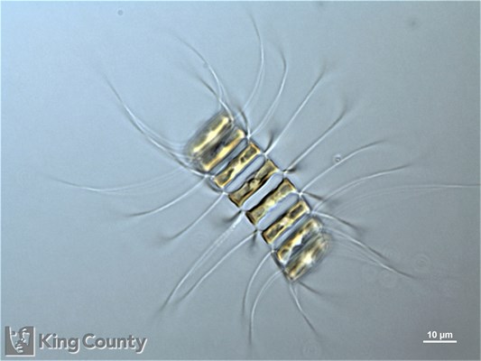 Photo of Chaetoceros debilis